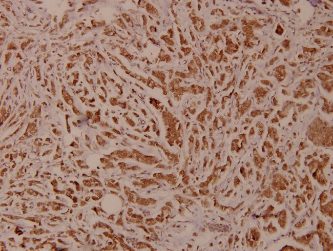 PLCG2 Antibody in Immunohistochemistry (Paraffin) (IHC (P))