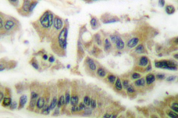 SGK1 Antibody in Immunohistochemistry (Paraffin) (IHC (P))