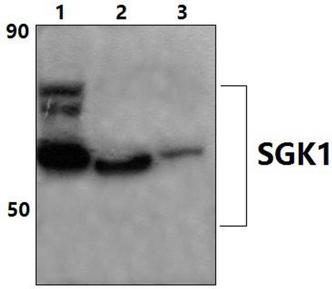 SGK1 Antibody in Western Blot (WB)