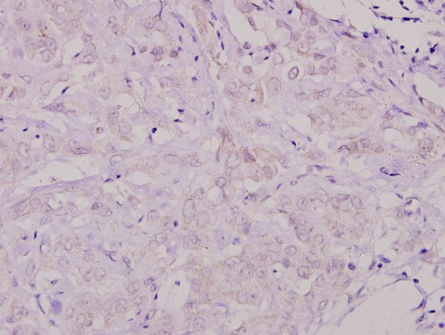 SHC Antibody in Immunohistochemistry (Paraffin) (IHC (P))