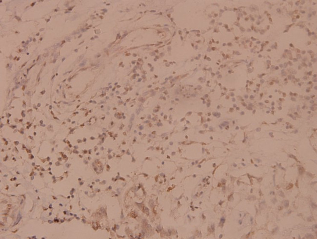 SHP-1 Antibody in Immunohistochemistry (Paraffin) (IHC (P))