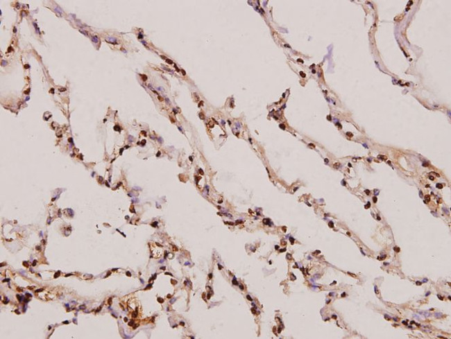 gamma Synuclein Antibody in Immunohistochemistry (Paraffin) (IHC (P))