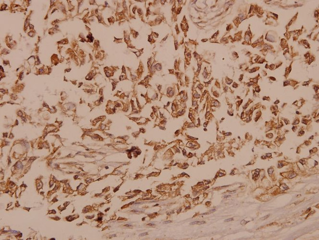 TrkB Antibody in Immunohistochemistry (Paraffin) (IHC (P))