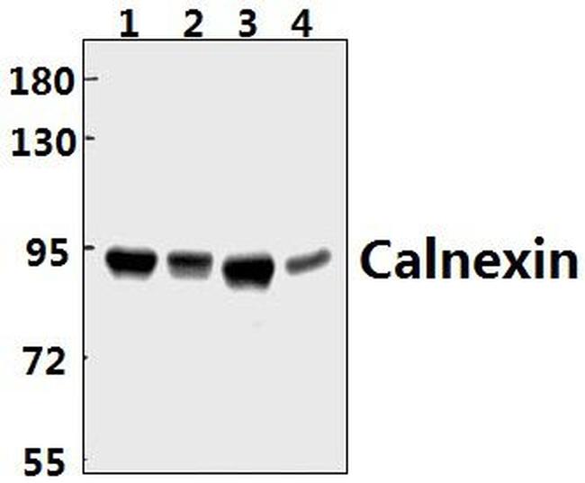 Calnexin Antibody in Western Blot (WB)