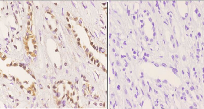 MDM2 Antibody in Immunohistochemistry (Paraffin) (IHC (P))