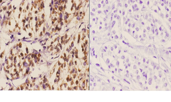 MDM2 Antibody in Immunohistochemistry (Paraffin) (IHC (P))