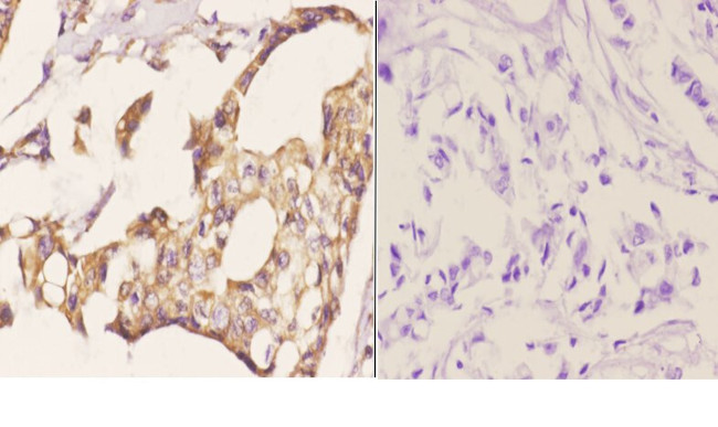 MDM2 Antibody in Immunohistochemistry (Paraffin) (IHC (P))