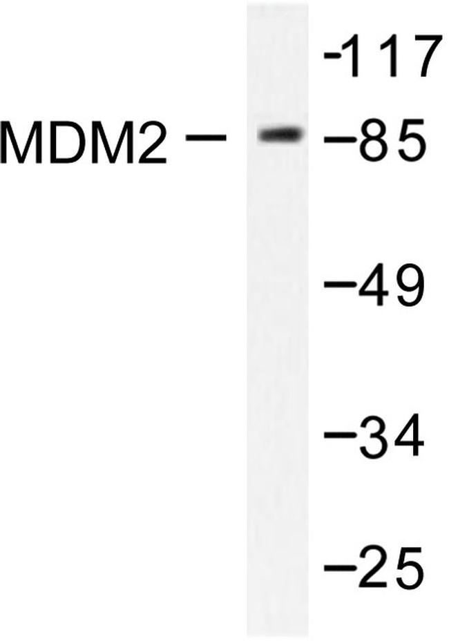 MDM2 Antibody in Western Blot (WB)