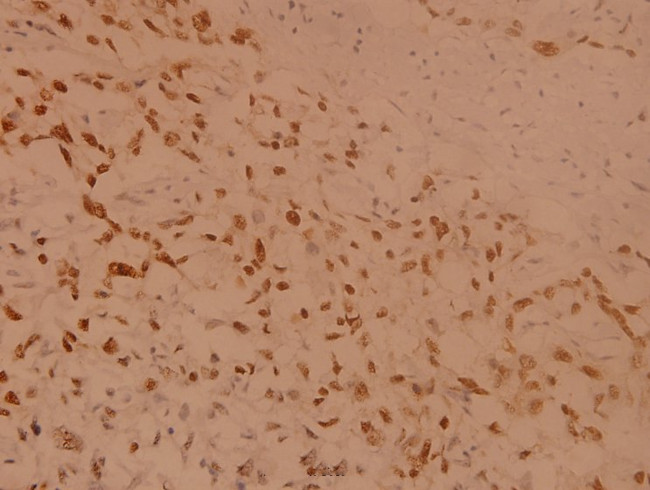 RSK1 Antibody in Immunohistochemistry (Paraffin) (IHC (P))