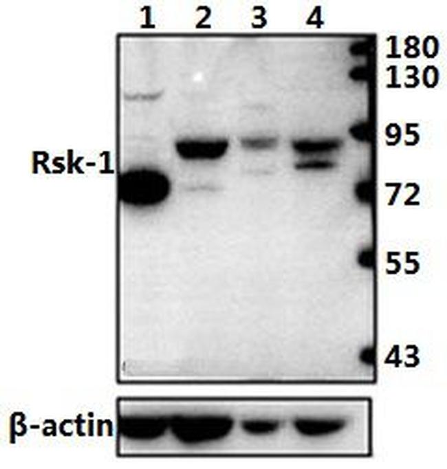 RSK1 Antibody in Western Blot (WB)