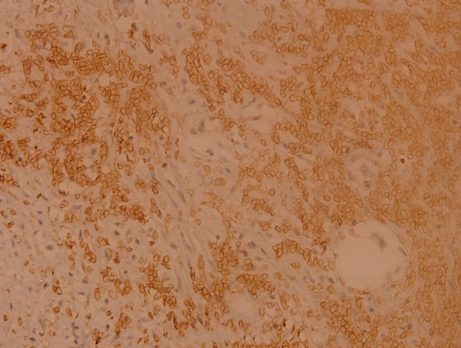 RSK1 Antibody in Immunohistochemistry (Paraffin) (IHC (P))