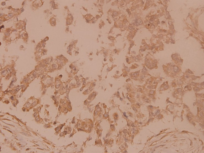 gamma Tubulin Antibody in Immunohistochemistry (Paraffin) (IHC (P))