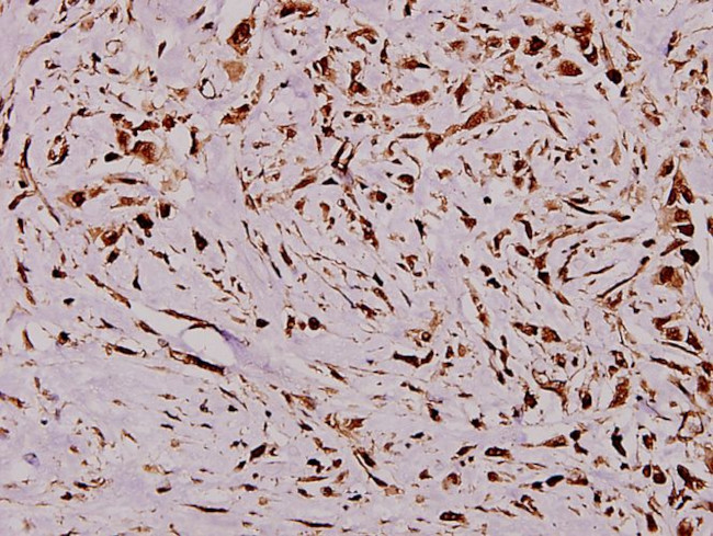 Vimentin Antibody in Immunohistochemistry (Paraffin) (IHC (P))