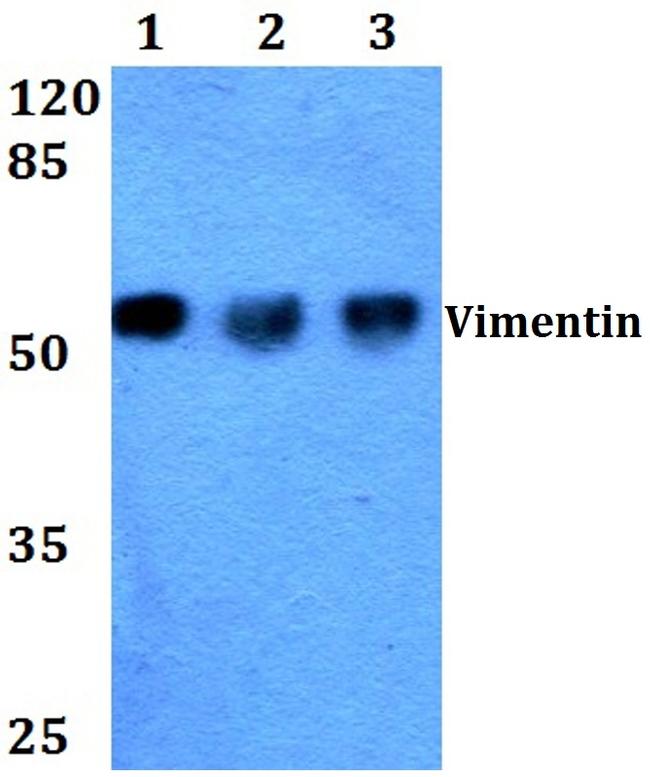 Vimentin Antibody in Western Blot (WB)