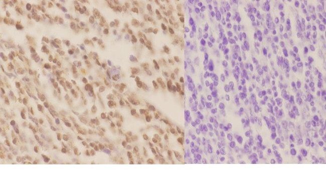 XPA Antibody in Immunohistochemistry (Paraffin) (IHC (P))