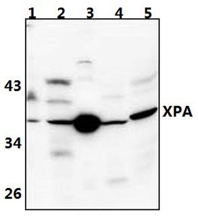 XPA Antibody in Western Blot (WB)