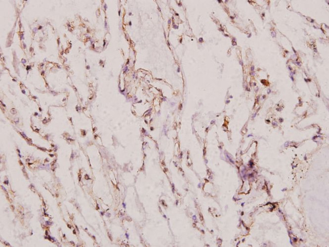 XRCC1 Antibody in Immunohistochemistry (Paraffin) (IHC (P))