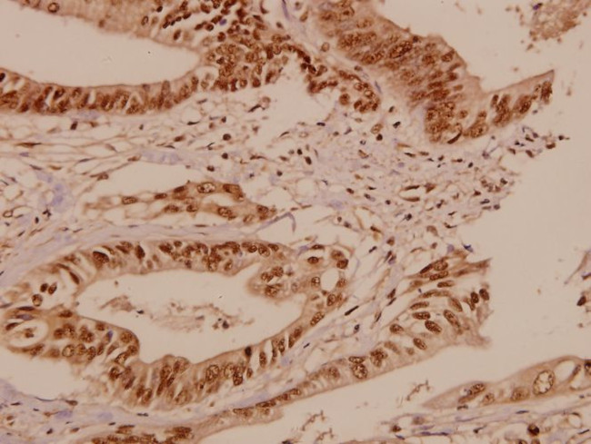 BCR Antibody in Immunohistochemistry (Paraffin) (IHC (P))