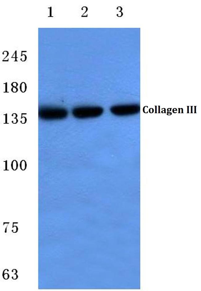 Collagen III Antibody in Western Blot (WB)