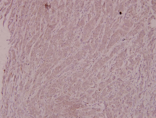 IKK beta Antibody in Immunohistochemistry (Paraffin) (IHC (P))