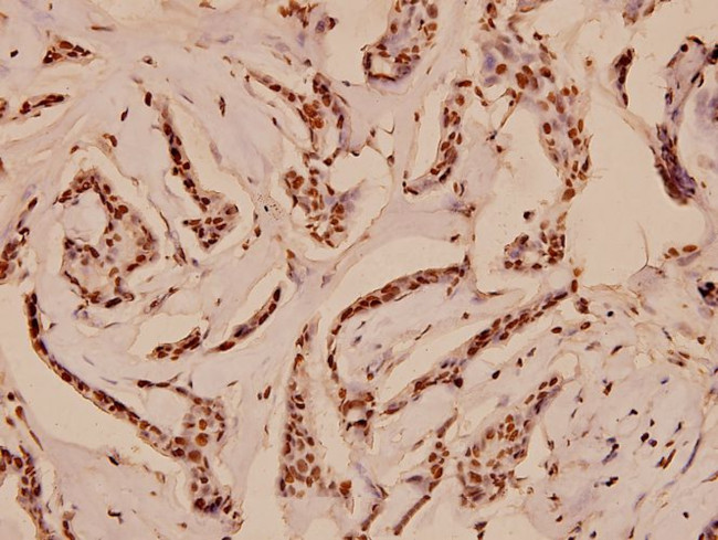 Myb Antibody in Immunohistochemistry (Paraffin) (IHC (P))