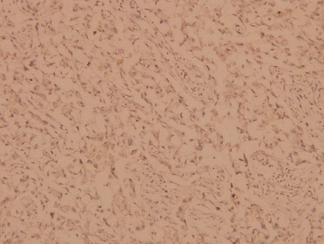 PKC alpha Antibody in Immunohistochemistry (Paraffin) (IHC (P))