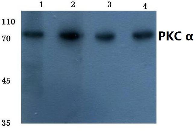 PKC alpha Antibody in Western Blot (WB)