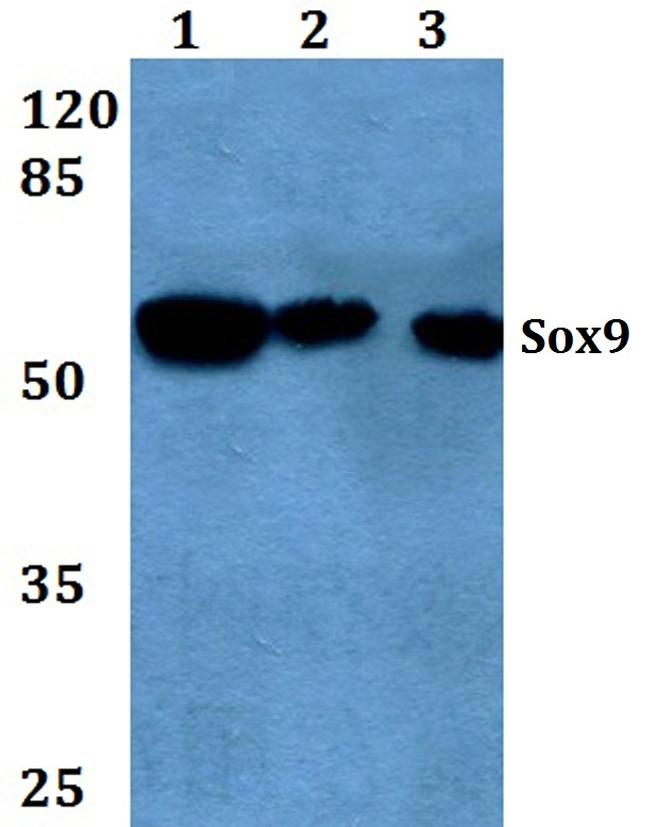 SOX9 Antibody in Western Blot (WB)