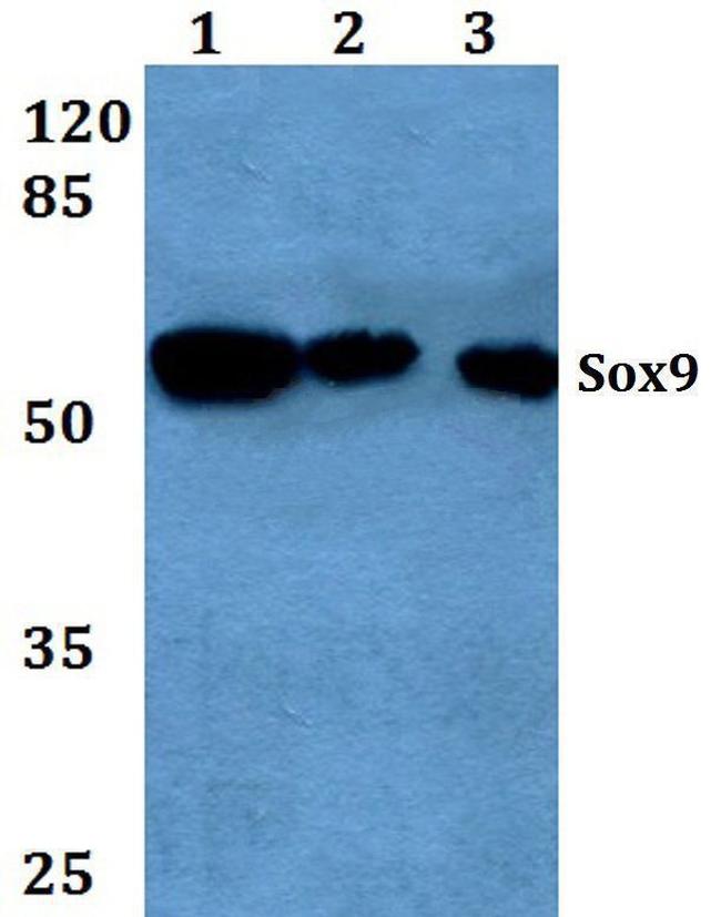 SOX9 Antibody in Western Blot (WB)