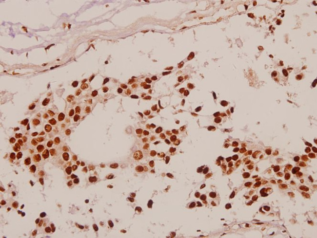 SP1 Antibody in Immunohistochemistry (Paraffin) (IHC (P))