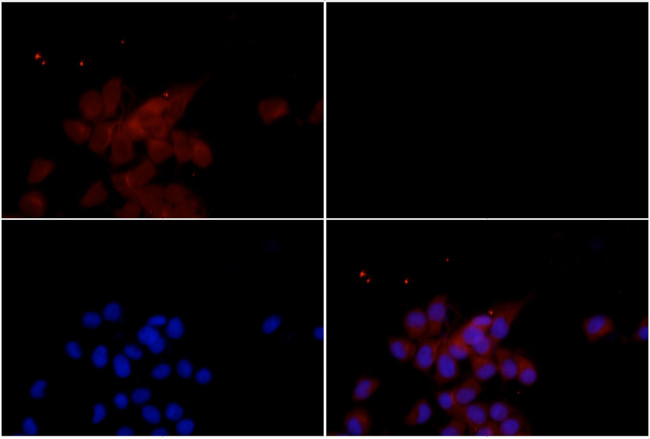 TSC2 Antibody in Immunocytochemistry (ICC/IF)