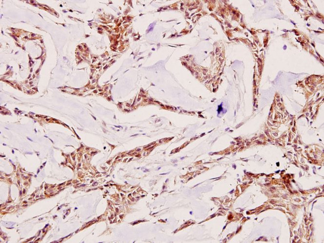 TSC2 Antibody in Immunohistochemistry (Paraffin) (IHC (P))