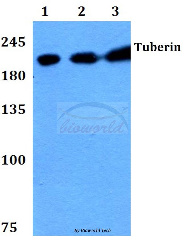 TSC2 Antibody in Western Blot (WB)