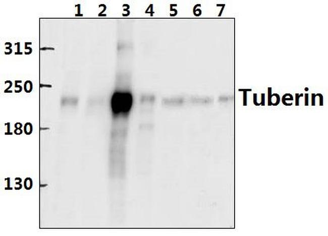 TSC2 Antibody in Western Blot (WB)