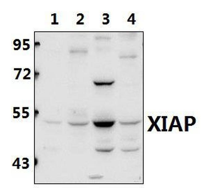 XIAP Antibody in Western Blot (WB)