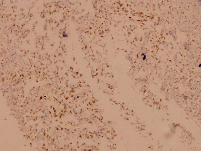 CRYAB Antibody in Immunohistochemistry (Paraffin) (IHC (P))