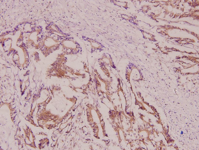 DAPK2 Antibody in Immunohistochemistry (Paraffin) (IHC (P))