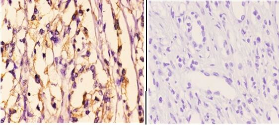 HDAC6 Antibody in Immunohistochemistry (Paraffin) (IHC (P))