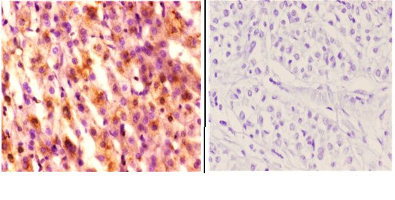 HDAC6 Antibody in Immunohistochemistry (Paraffin) (IHC (P))