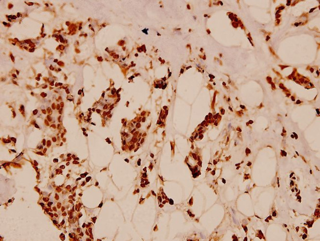 Histone H2B Antibody in Immunohistochemistry (Paraffin) (IHC (P))