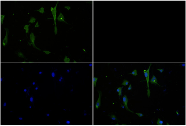 JAK3 Antibody in Immunocytochemistry (ICC/IF)