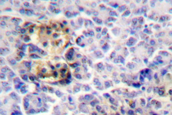 Moesin Antibody in Immunohistochemistry (Paraffin) (IHC (P))