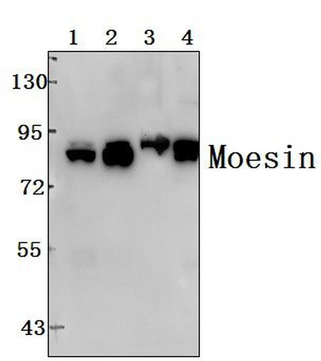 Moesin Antibody in Western Blot (WB)