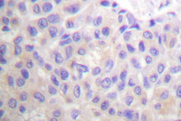 p130Cas Antibody in Immunohistochemistry (Paraffin) (IHC (P))