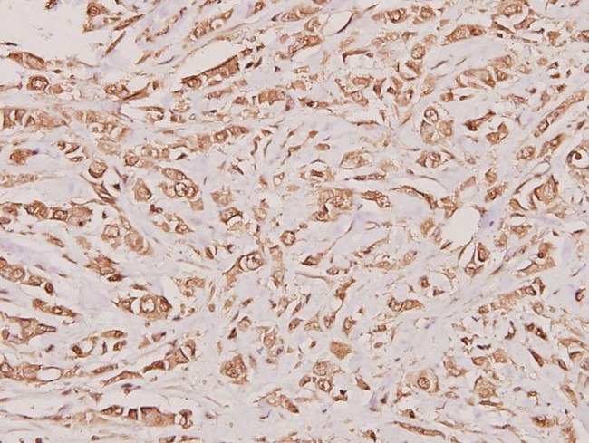 Cystatin A Antibody in Immunohistochemistry (Paraffin) (IHC (P))