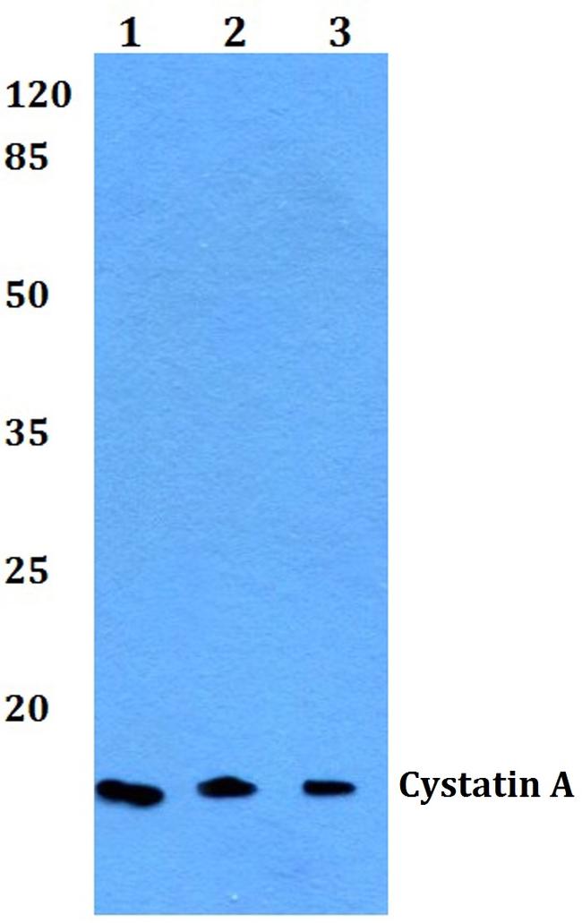 Cystatin A Antibody in Western Blot (WB)