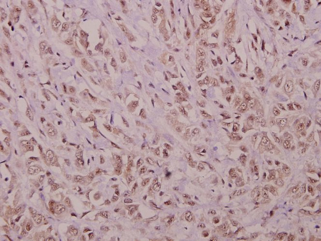 YAP1 Antibody in Immunohistochemistry (Paraffin) (IHC (P))