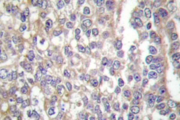 SHC Antibody in Immunohistochemistry (Paraffin) (IHC (P))