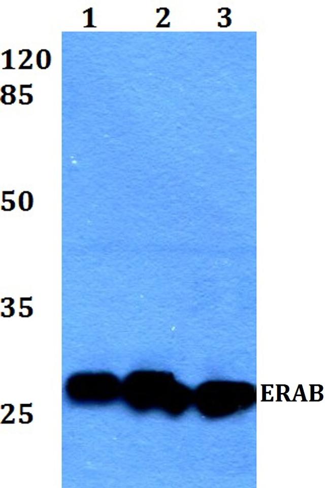 ERAB Antibody in Western Blot (WB)