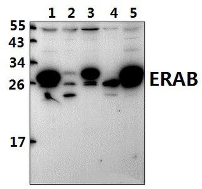 ERAB Antibody in Western Blot (WB)